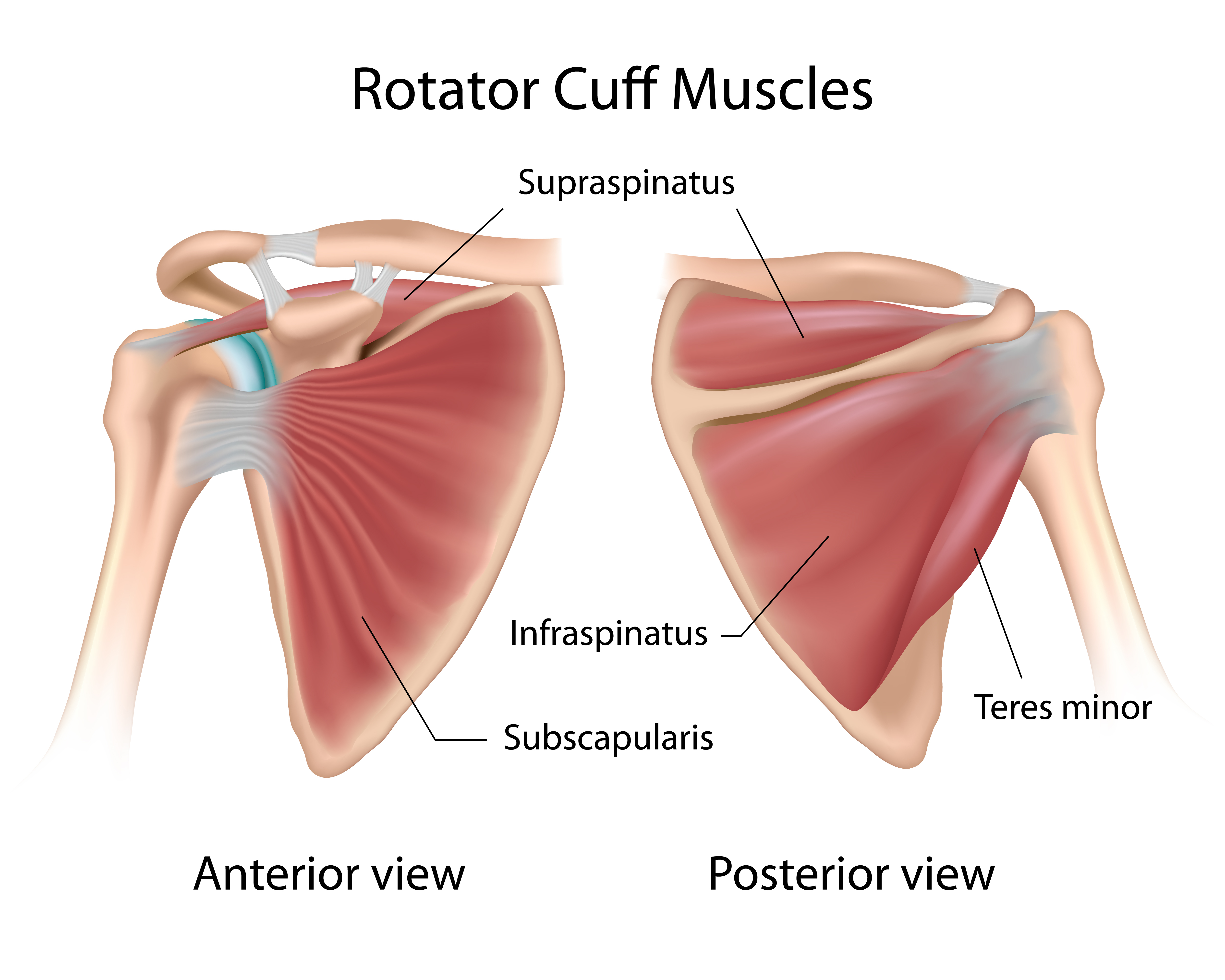 rotary cup shoulder
